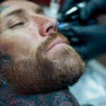 fjern tatovering odense